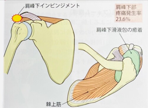 肩峰下部