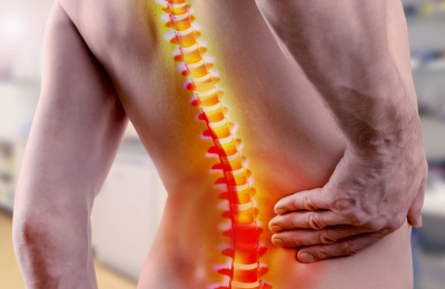 腰椎椎間板ヘルニア